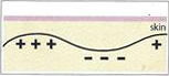 microcurrent principle