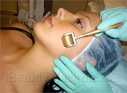 Dermaroller vs Mesotherapy Derma Roller treatment