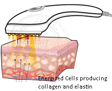 Red photon skin care device